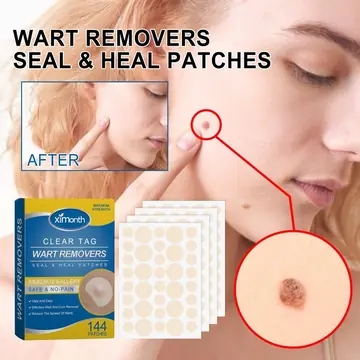 Fade Nevus Wart Repair Flesh Bump Smooth Paste