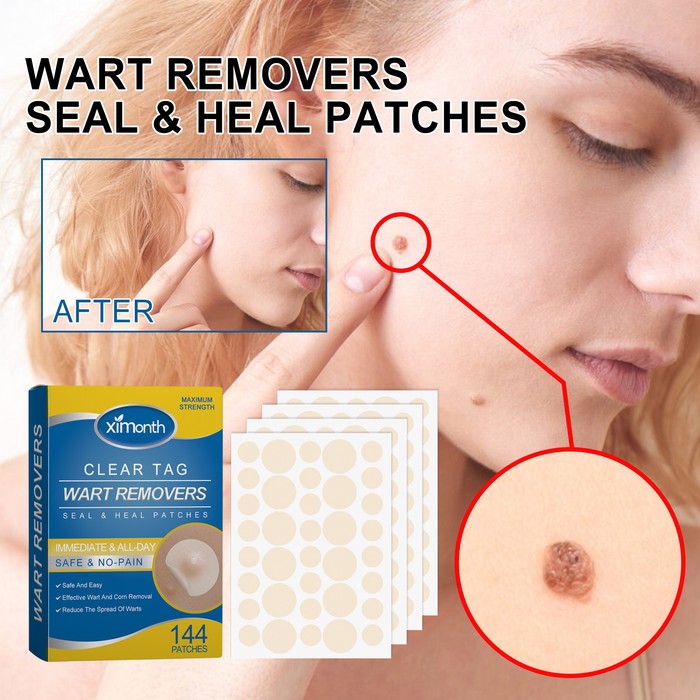 Fade Nevus Wart Repair Flesh Bump Smooth Paste